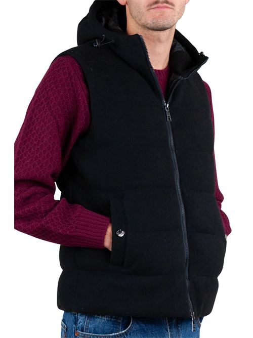  OVER-D | OC1F2W5J01NE